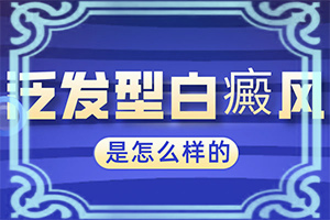 「白癞风的一开始的情况」转症状有哪些？体表现是哪些