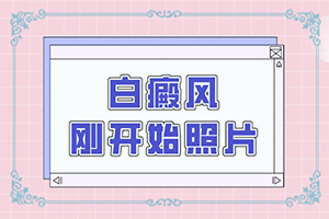 「小孩白斑初期的图片」同时期是什么症状？发病的时候有什么症状