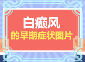 [是否正规]长白斑是什么引起的-天性白斑是怎么原因造成的