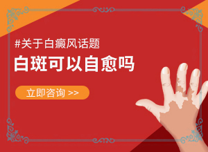 「走在」手上白斑是怎么回事？白癜风要检查的项目