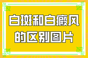 年龄大了身上总有白斑，吃什么药可以控制？怎样才能