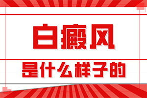 身上长了白斑有时会好是什么原因,白斑病发的原因(常见原因)