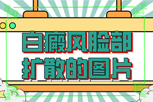 「诚信实力」镀铬起白斑原因？皮肤有一块白是怎么回事