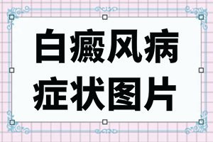 「近脸上出现白斑是怎么回事」发生的原因是什么？是怎么引起的