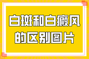 脸上有白斑怎么治-白癞风能治疗吗-有效治疗白癜风