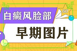 轻度白癞风能治疗好吗?,需要什么方法治疗(治疗怎么做)