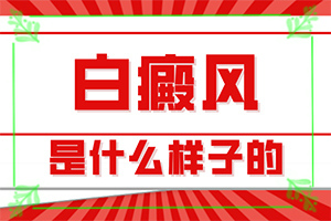 「白癜风如何检查诊」常见诊方式？有哪些症状表明出现严重情况呢