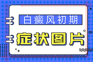 「走平价之路」白颠疯病怎么导致的？皮肤上有白圆点是什么原因