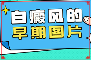 「2022推荐」儿童白斑图片是什么样子「提前揭秘」白癜风病的诊用什么方法