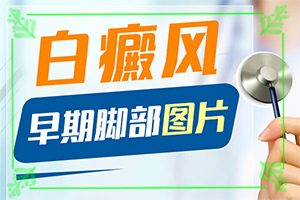 「详费用表」嘴唇角上有白斑怎么回事「深度」为什么会长白班