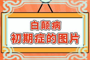 背长白斑是什么原因引起的(发作是什么原因)皮肤上有小白块是什么原因