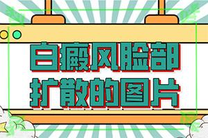 「诚信实力」镀铬起白斑原因？皮肤有一块白是怎么回事