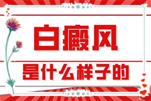 背上有白癫是怎么回事，有哪些诊断常识(持续发展会怎么样)