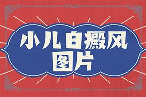 皮肤长白斑是怎么引起的怎么防治,诱发因素有哪些(原因有哪些)