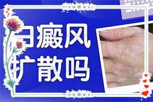 身体突然出现大块白斑什么情况，如何了解白斑病发(何种原因呢)